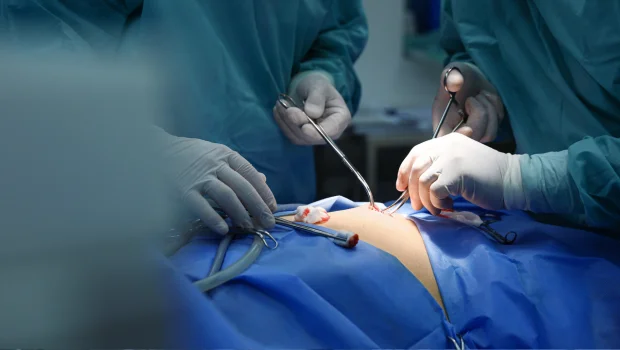 Laparoscopy & Hysteroscopy Treatment - Sg Hospital